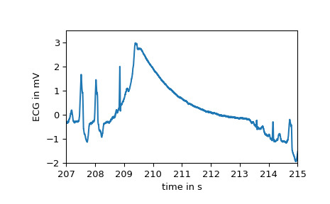 scipy-misc-electrocardiogram-1_02_00.png