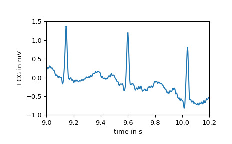 scipy-datasets-electrocardiogram-1_00_00.png