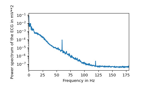 scipy-datasets-electrocardiogram-1_03_00.png