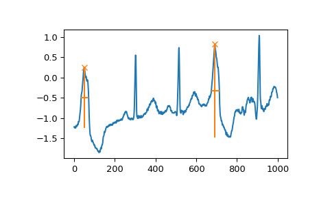 scipy-signal-find_peaks-1_04_00.png