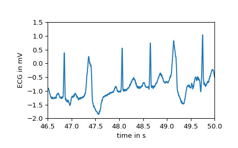 scipy-datasets-electrocardiogram-1_01_00.png